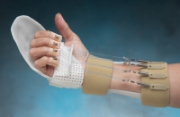 Fleksör Tendon Kesisi Splinti